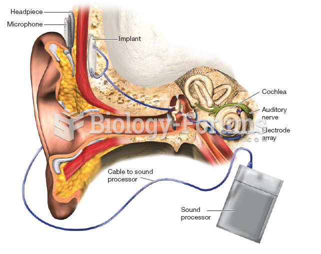 A cochlear implant 