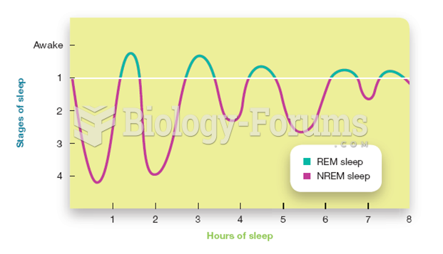 Order and Duration of Sleep Stages Through a Typical Night
