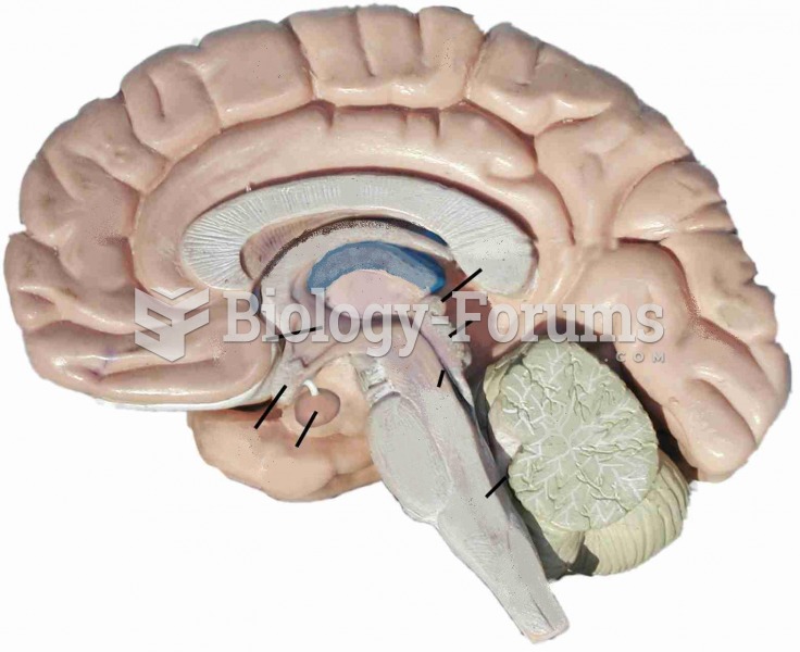 brain model