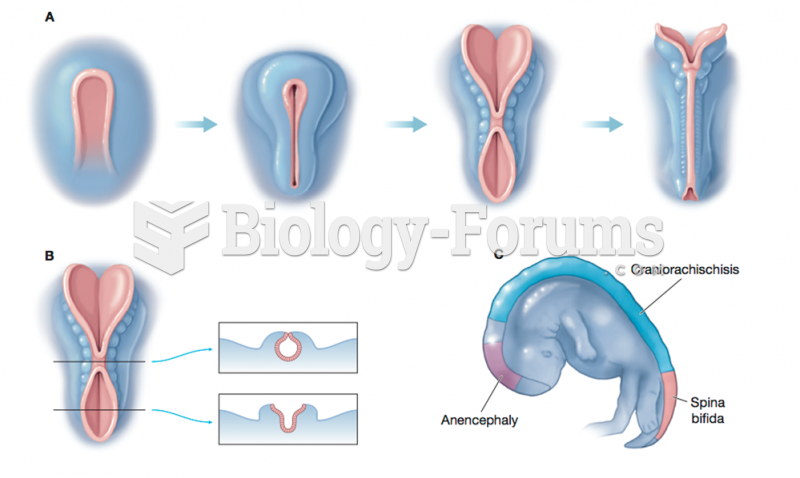 Formation of the Neural Tube  and Neural Tube Defects