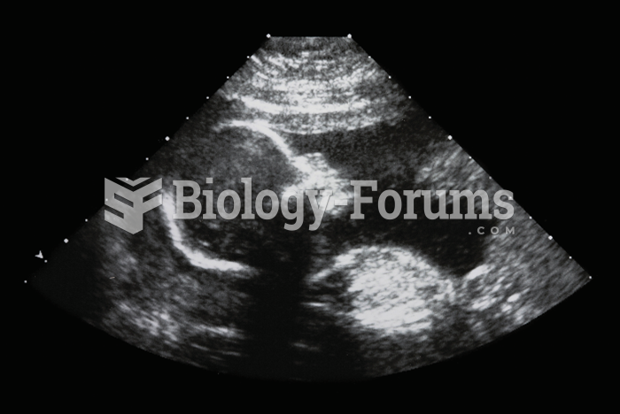 The photo shows an ultrasound image of a fetus of about 20 weeks’ gestational age.