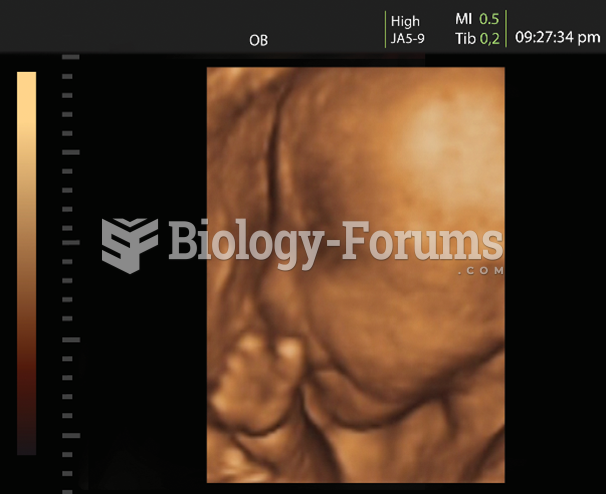 The photo shows an ultrasound image of a fetus. The rough outline of a head and body can be seen. ...