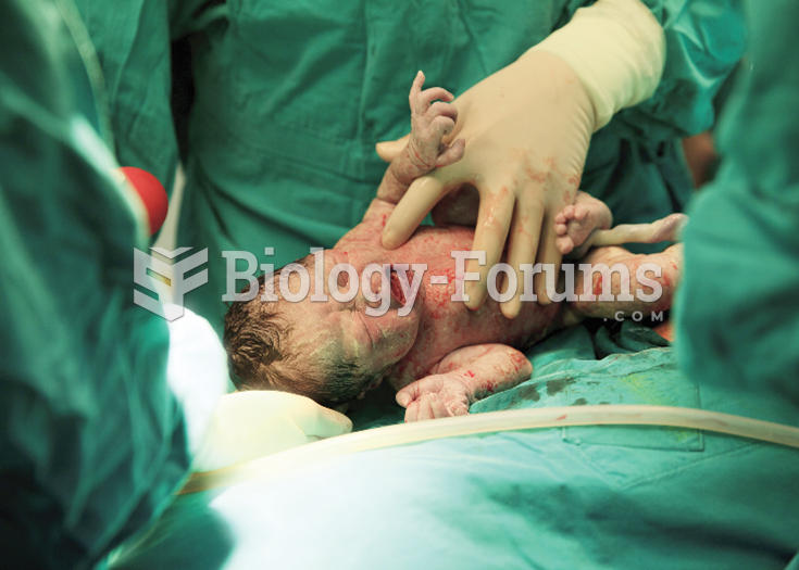 This photo shows a newborn baby minutes after birth.