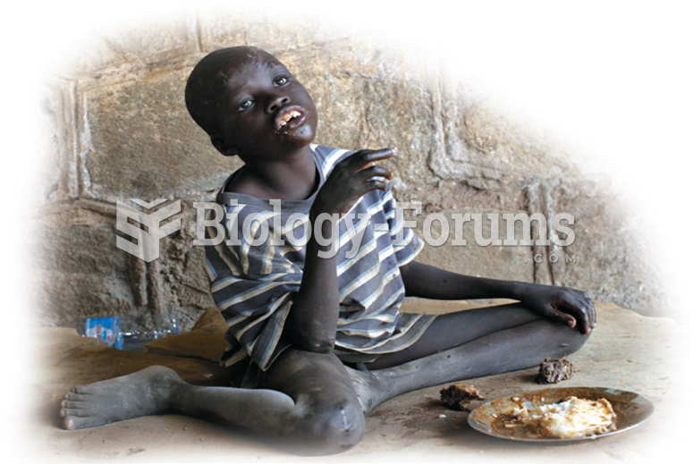 A child in an orphanage in Juba, Sudan. The treatment of this child is likely to affect his ability ...