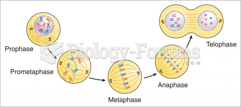 Stages of mitosis.