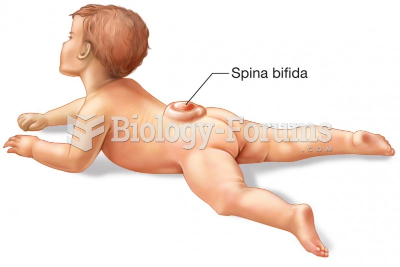 An infant with spina bifida.
