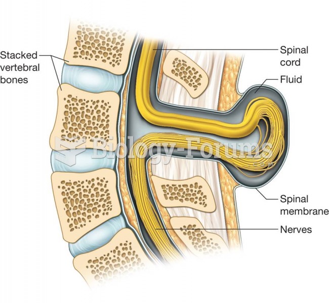 The spinal cord protrudes from the body.