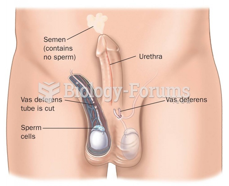 Vasectomy Procedure 