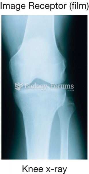 Bones do not allow the X-ray beam to pass through them, resulting in an image of the bones on the ...