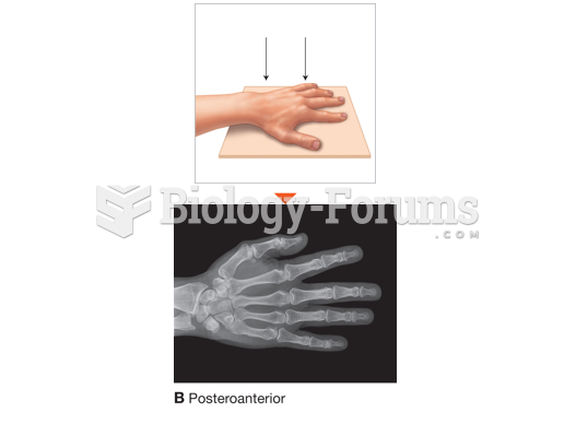 Examples of the most common X-ray positions and the images they produce. 