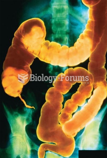 Radiograph of the colon after a barium enema. 