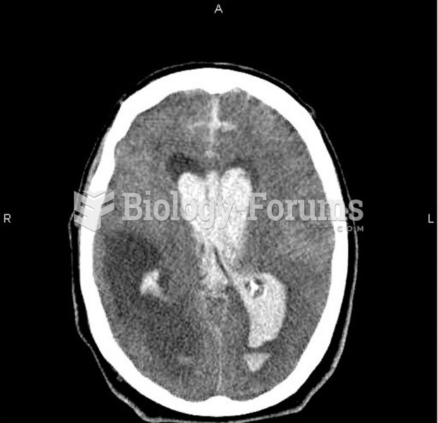 CT scan of the head shows a massive bleed with a midline shift. 