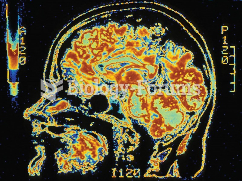 A color-enhanced MRI image of the skull.