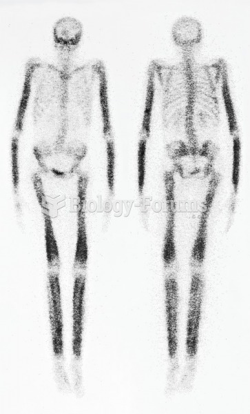 A nuclear medicine bone scan. 