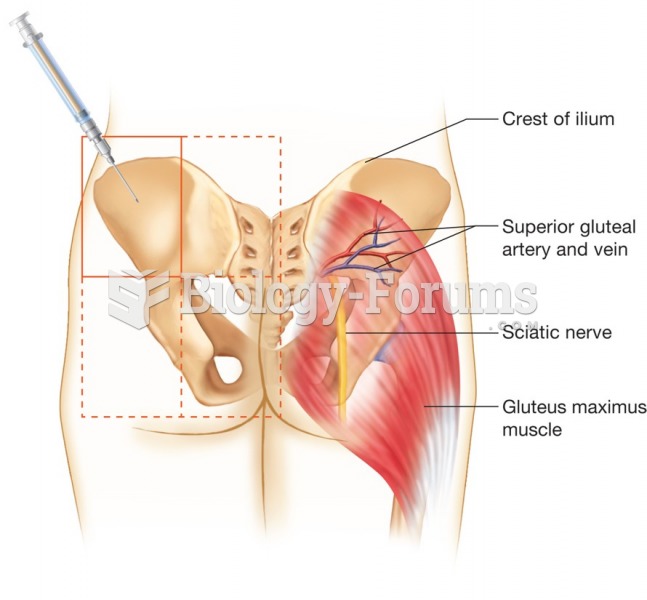 Injecting the upper outer quadrant of the buttocks.