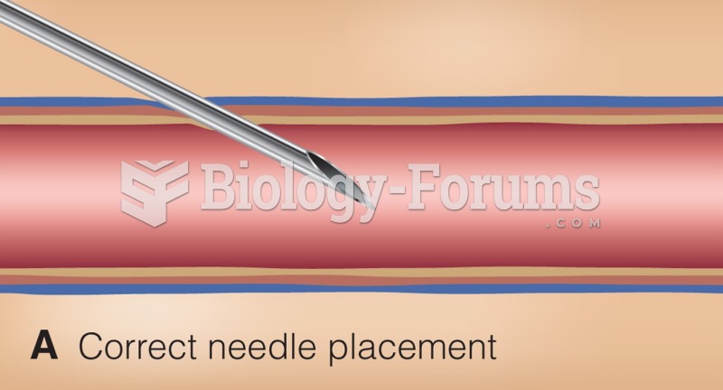 Common phlebotomy issues.