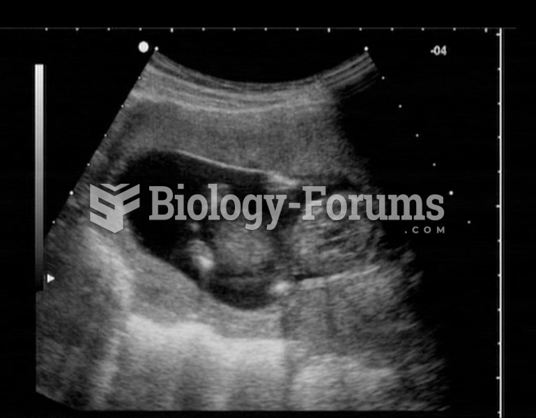 Ultrasonogram showing a male fetus. 