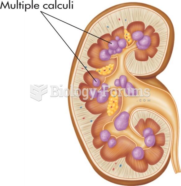 Multiple urinary calculi.