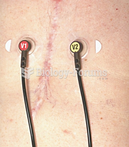 Recording a 12-Lead Electrocardiograph