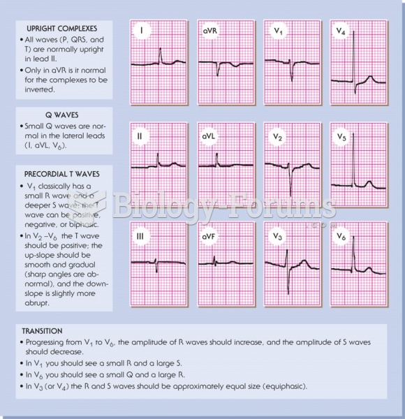Features of a normal 12-lead ECG.