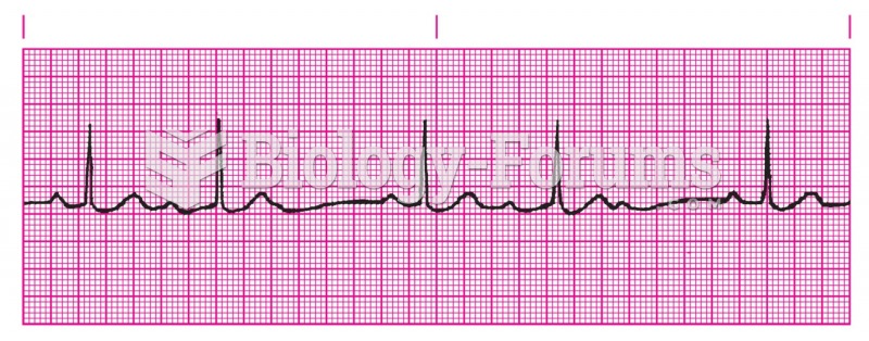 Third-degree heart block.