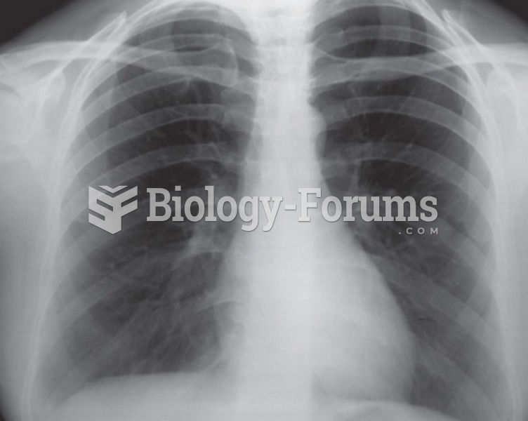 A normal chest X-ray.