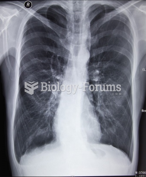 Chest X-ray of a patient with emphysema. 