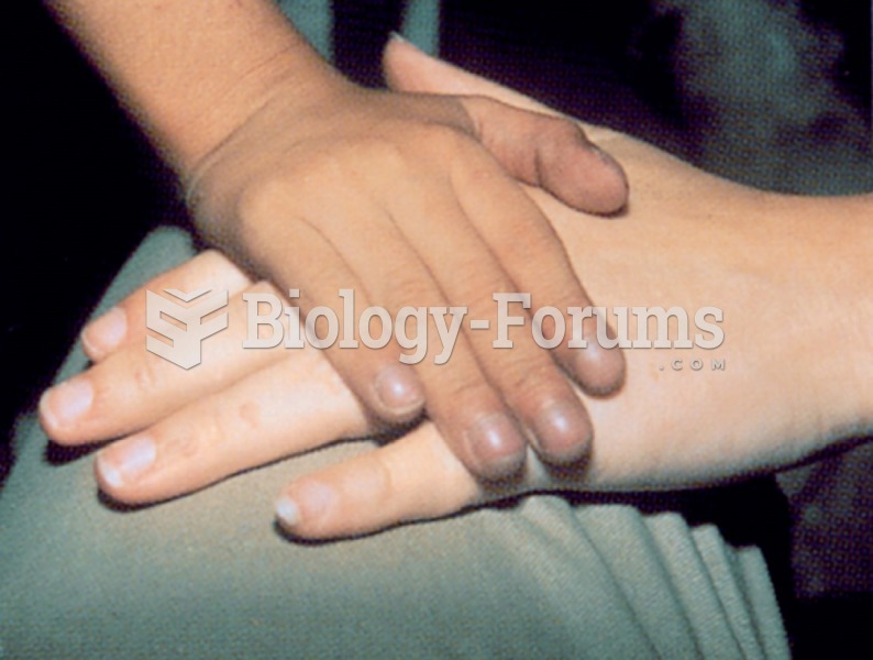 Cyanosis as shown here at the patient’s fingertips results from a lack of oxygen in the tissues