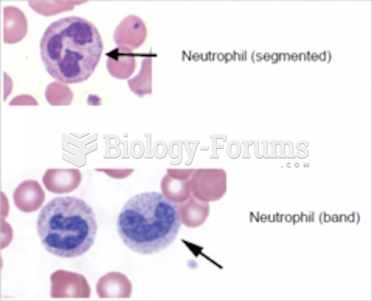 Band and segmented neutrophils.