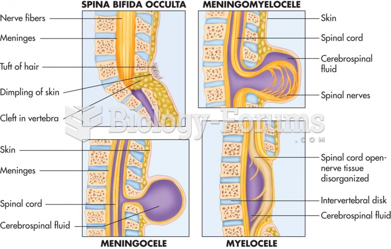 The various forms of spina bifida