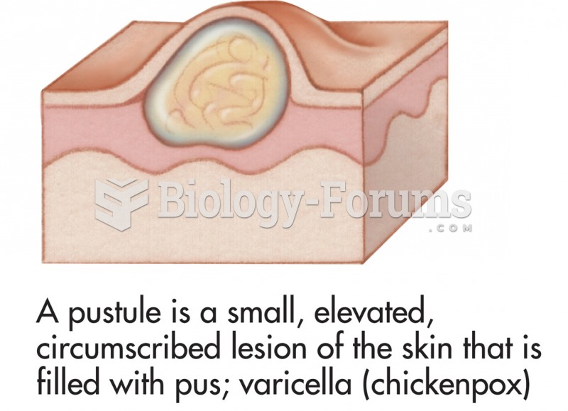 Common skin signs are often evidence of an illness or disorder. A pustule is a small, elevated, ...