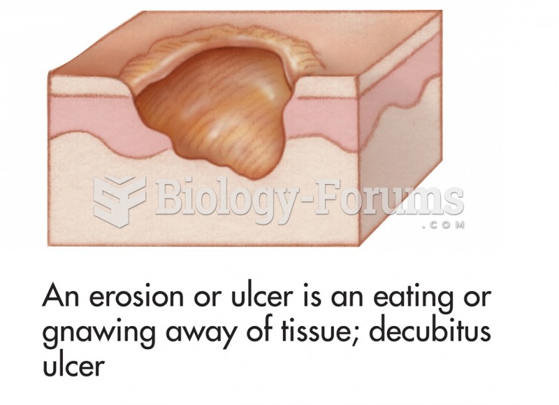 Common skin signs are often evidence of an illness or disorder. An erosion or ulcer is an eating or ...