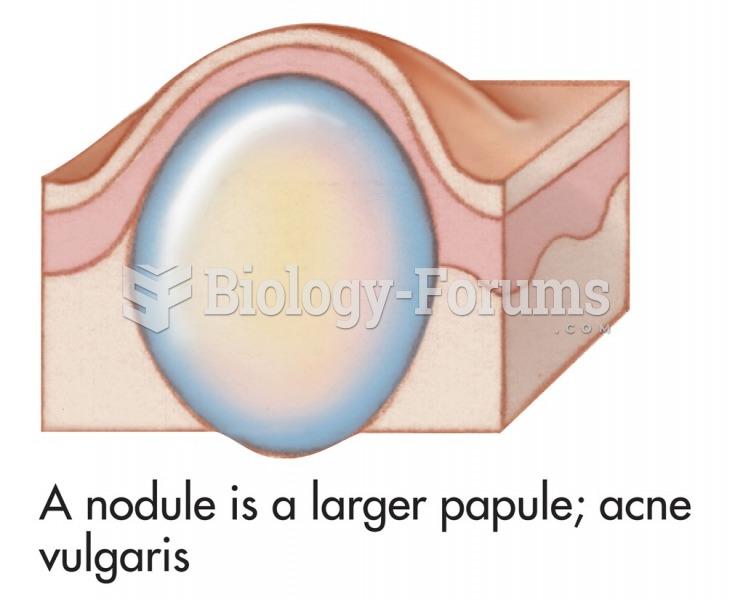 Common skin signs are often evidence of an illness or disorder. A nodule is a larger papule; acne ...