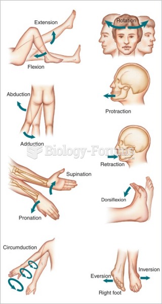 Types of body movements.