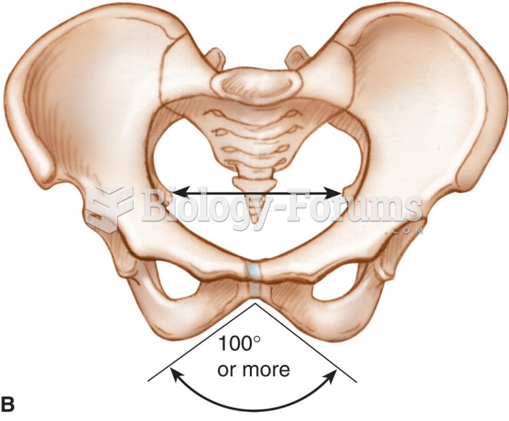 The female pelvis.