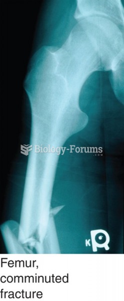 Fractures are diagnosed based on an X-ray of the broken bone. Shown here: a comminuted fracture of ...