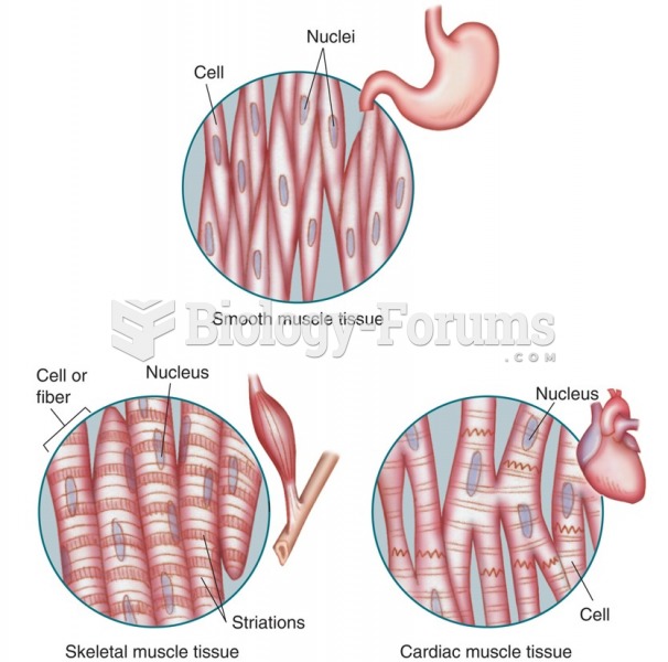 Types of muscle tissue.