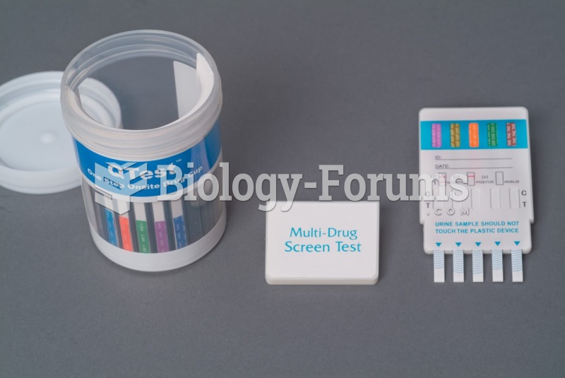 Example of equipment used for a urine drug screen that a medical office may require before ...