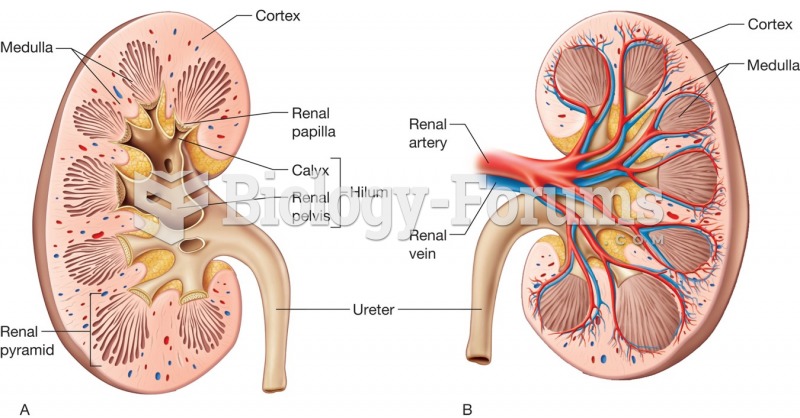 A) Sectioned kidney; (B) renal artery and vein.