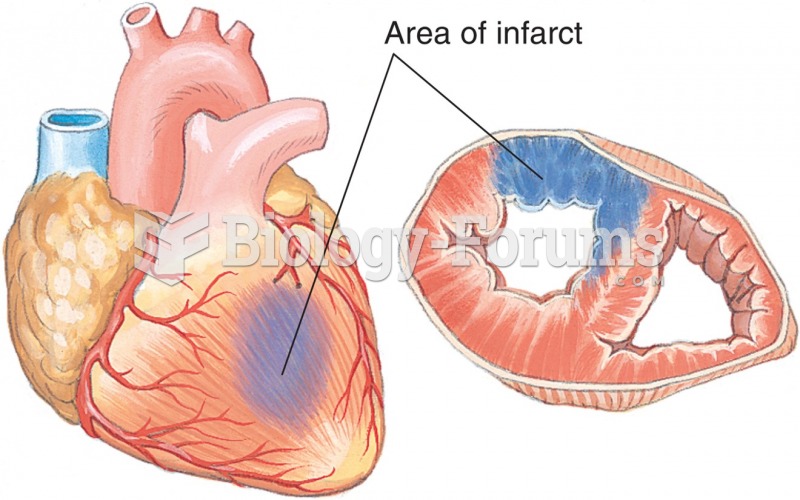 Cross section of a myocardial infarction.