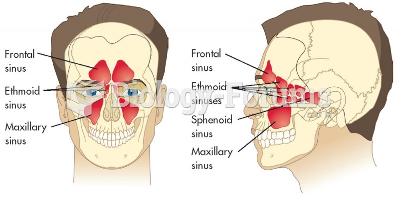The four pairs of paranasal sinuses.