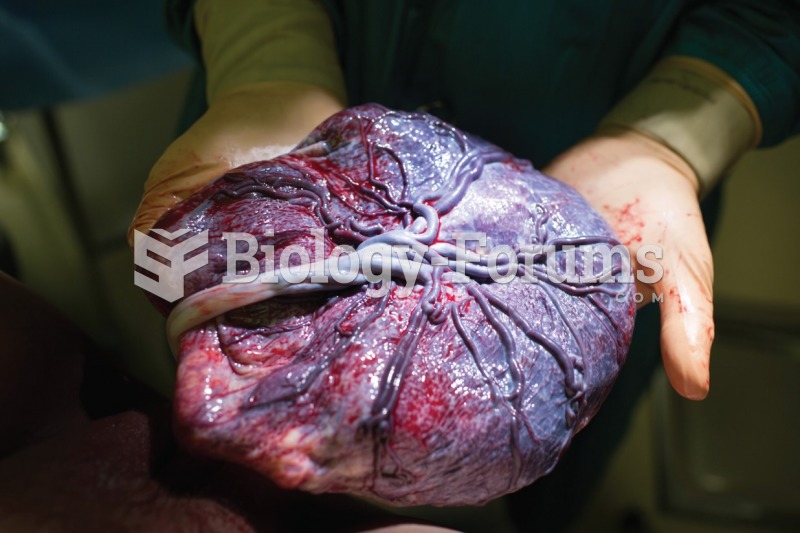 A doctor showing the placenta after childbirth. 