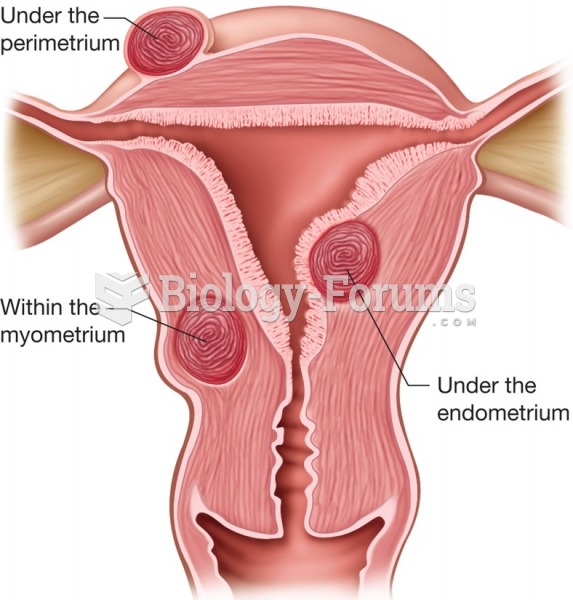 Types of uterine fibroids.