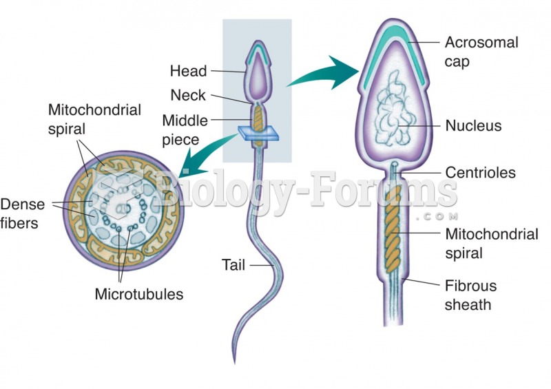 The basic structure of a spermatozoon (SPERM).