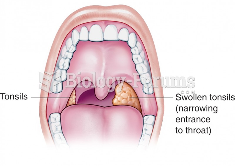 Tonsils—normal and enlarged.