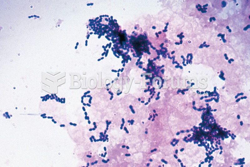 Gram positive S. pyogenes bacteria in chains.