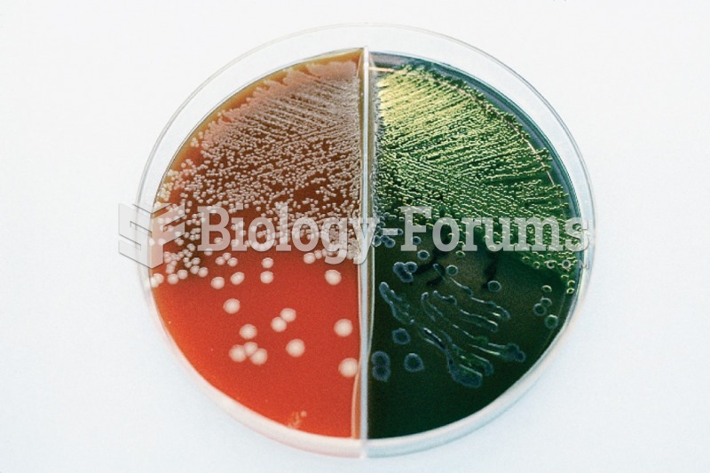 Mold is growing on red/green agar in a divided Petri dish.