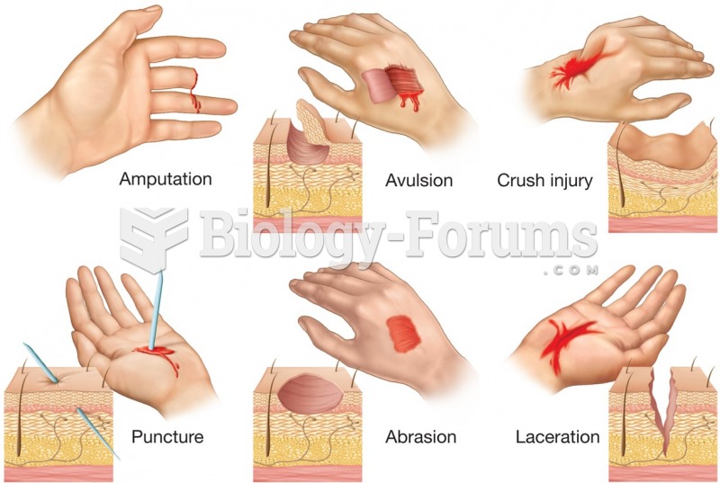 Classification of open injuries.