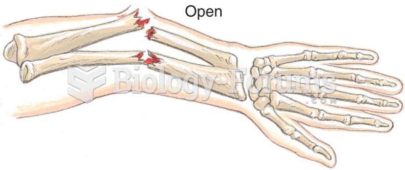 An open fracture.