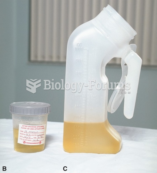 (B) Urine collection cup; (C) 24-hour urine container.